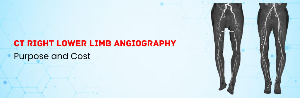 CT Right Lower Limb Angiography Test: Purpose and Cost